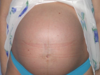obrázek 32. týden těhotenství - profil