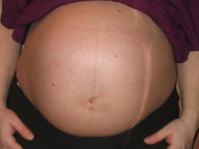 obrázek 40. týden těhotenství - profil