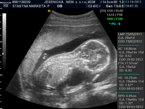obrázek ultrazvuk